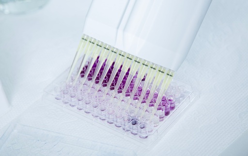 [GEN-TTK-1000-S-RLD-E] 1200uL XL Low Retention Filter Pipette Tips - RNase and DNase Free, Sterile